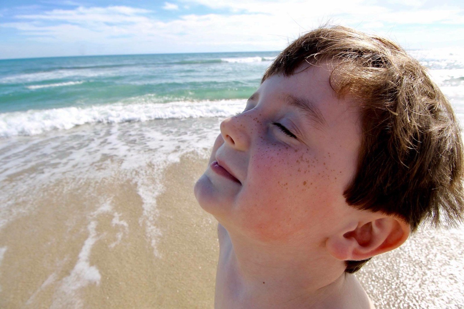Vero Beach Freckles
